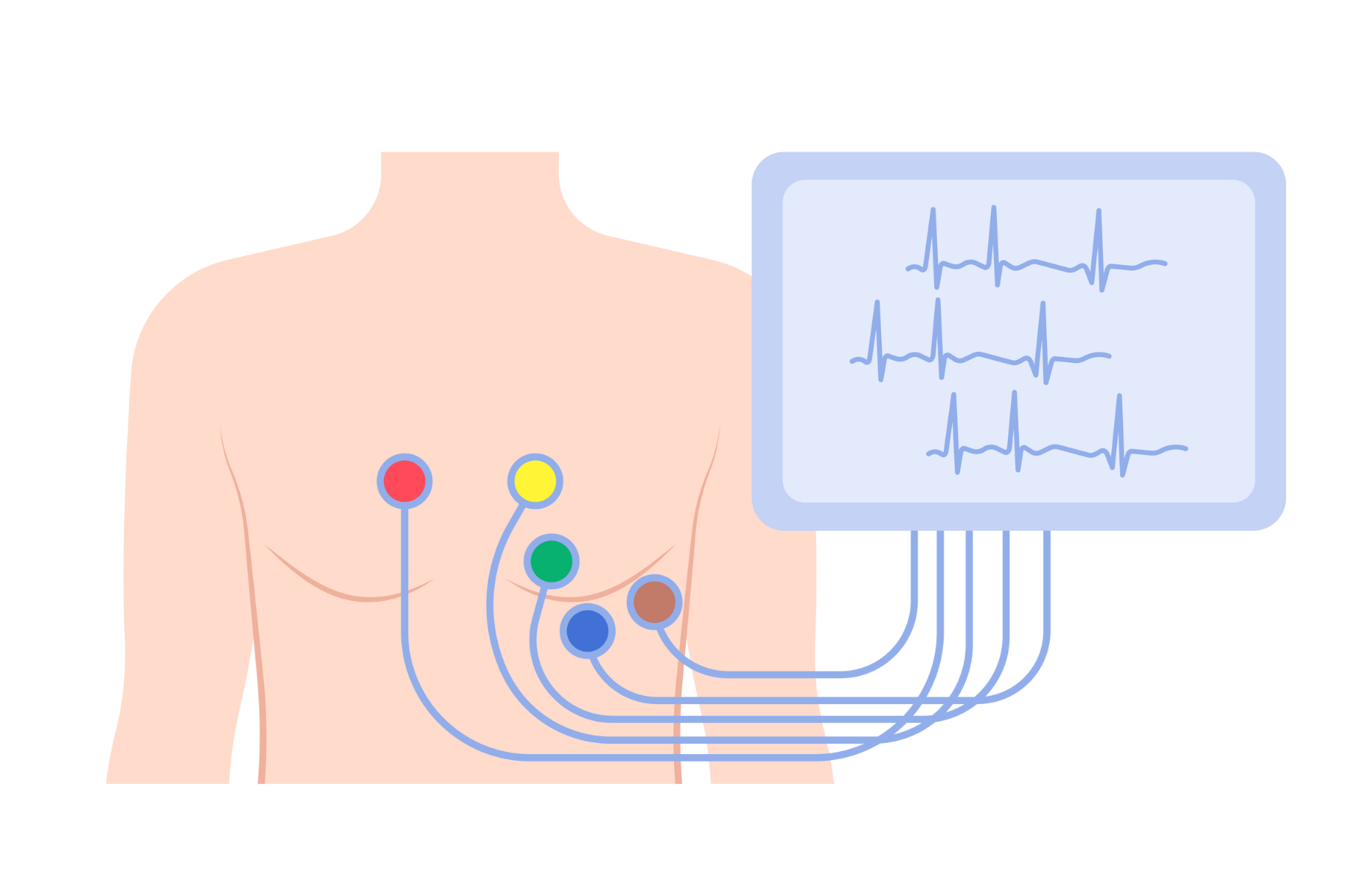 Holter 24 horas o que é para que serve resultados Blog Saúde Trevo